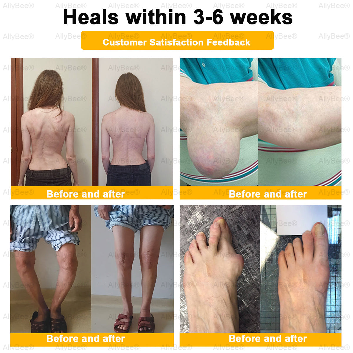 AllyBee™ Botulinum Toxin & Bee Venom Pain-Relief Bone Healing Cream