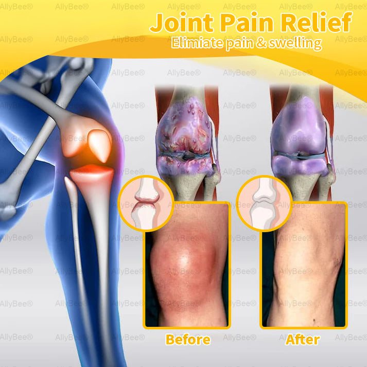 AllyBee™ Botulinum Toxin & Bee Venom Pain-Relief Bone Healing Cream