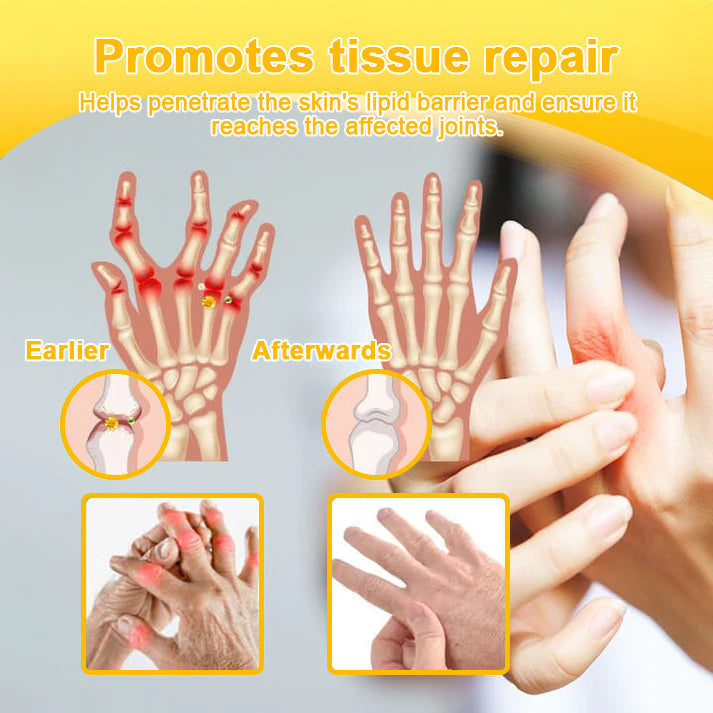 AllyBee™ Botulinum Toxin & Bee Venom Pain-Relief Bone Healing Cream