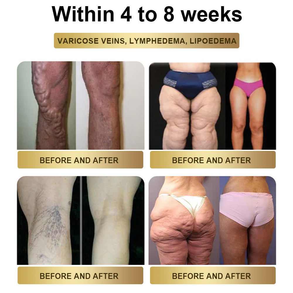 Hurry, only 10 bottles left! Get 50% off and start your journey to a healthier you! 🎯 With every purchase, you have a 50% chance to win a $50 gift! 🎁 Don’t miss out—this deal won’t return until next year! ⏳ Act fast!