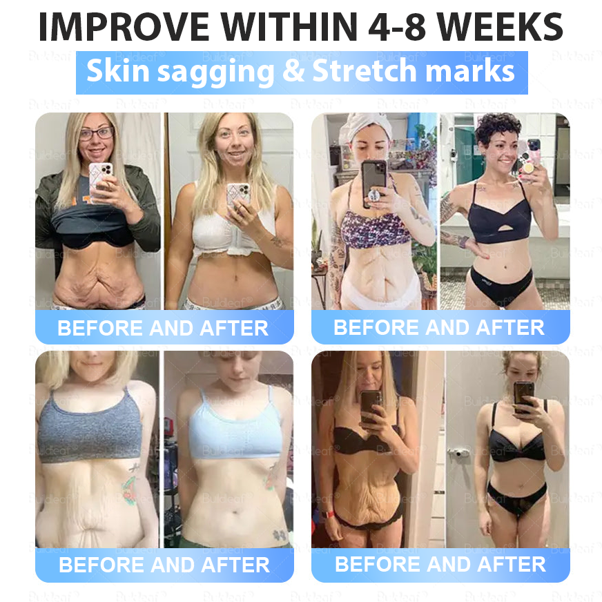 Only 10 Boxes left! We're offering you an additional 30% discount! Get yourself in shape and healthy. Miss out now, and you won't have another chance until next year. BuildLeaf®