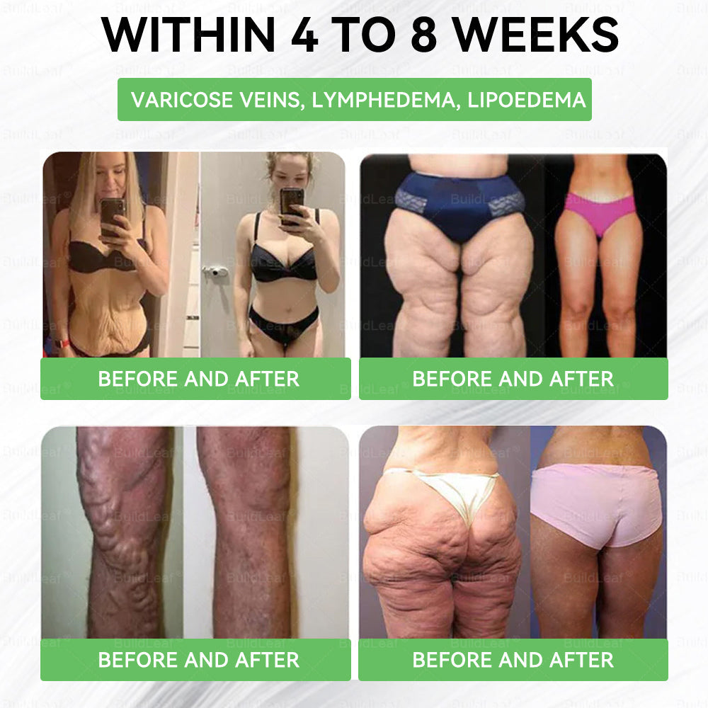 Only 10 Boxes left! We're offering you an additional 30% discount! Get yourself in shape and healthy. Miss out now, and you won't have another chance until next year.CrazyLeafยฎ