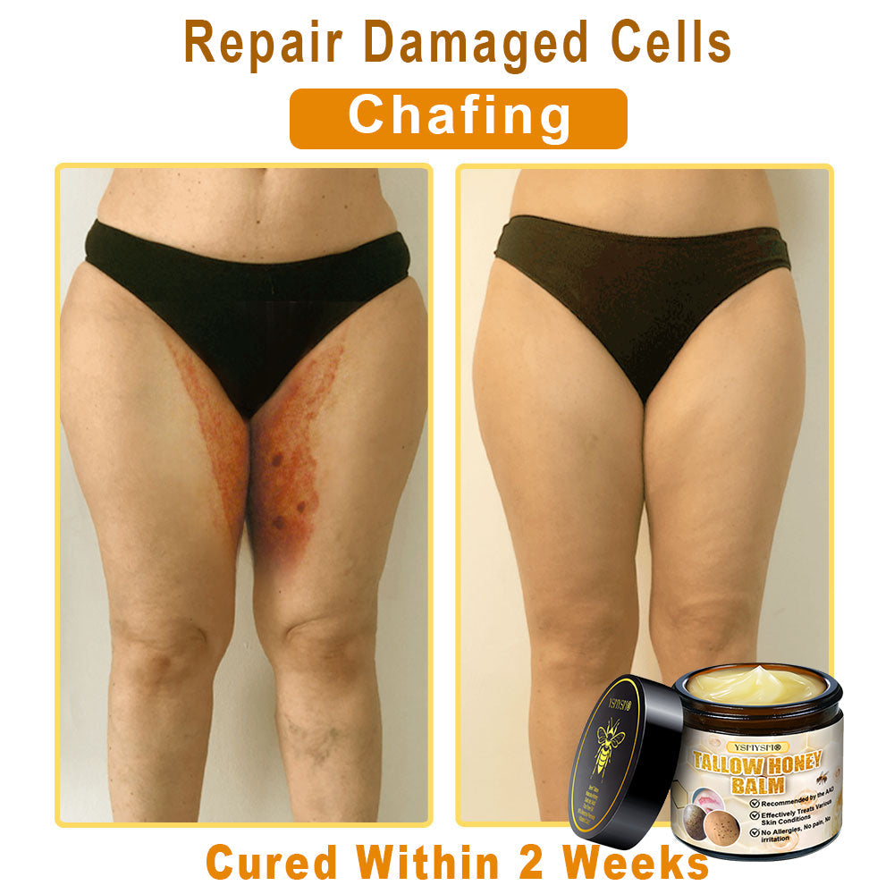 YSMYSM® Bee Venom and Tallow Comprehensive Cream: Anti-Aging, Hydration, Skin Repair, Even Tone, Acne & Dark Spot Treatment, Wart & Mole Removal, Psoriasis Relief