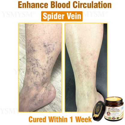 Only 5 jars! Grab an exclusive 50% discount now! Keep your skin youthful and glowing in just 1 to 4 weeks. Don’t miss your chance—this offer won’t come around again until next year. Act fast! 180-day money back guarantee!