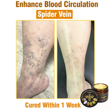 Mayo Clinic Official:AllyBee™ Bee Venom TALLOW ALL-in-oneTreatment Cream for Anti-Aging, Acne, Scars, Warts, Psoriasis, Dark Spots, Wrinkles & Eczema Relief