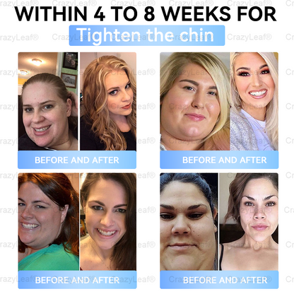 Only 10 Boxes left! We're offering you an additional 30% discount! Get yourself in shape and healthy. Miss out now, and you won't have another chance until next year. BuildLeaf®