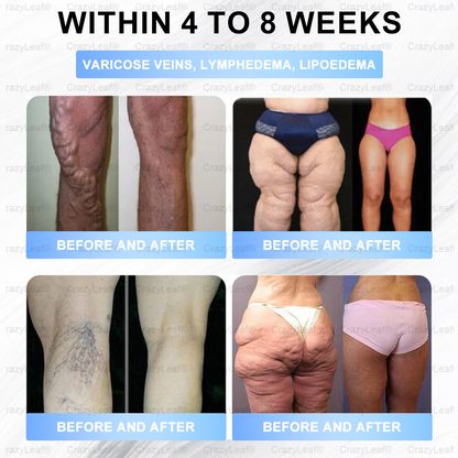 Only 10 Boxes left! We're offering you an additional 30% discount! Get yourself in shape and healthy. Miss out now, and you won't have another chance until next year. BuildLeaf®