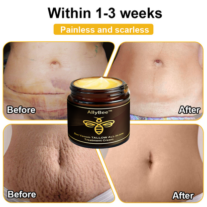 Mayo Clinic Official:AllyBee™ Bee Venom TALLOW ALL-in-oneTreatment Cream for Anti-Aging, Acne, Scars, Warts, Psoriasis, Dark Spots, Wrinkles & Eczema Relief